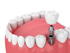 Adobestock 195945547 768x576