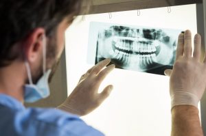 Periodontal Pockets