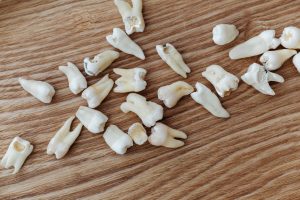 Teeth Fall Out