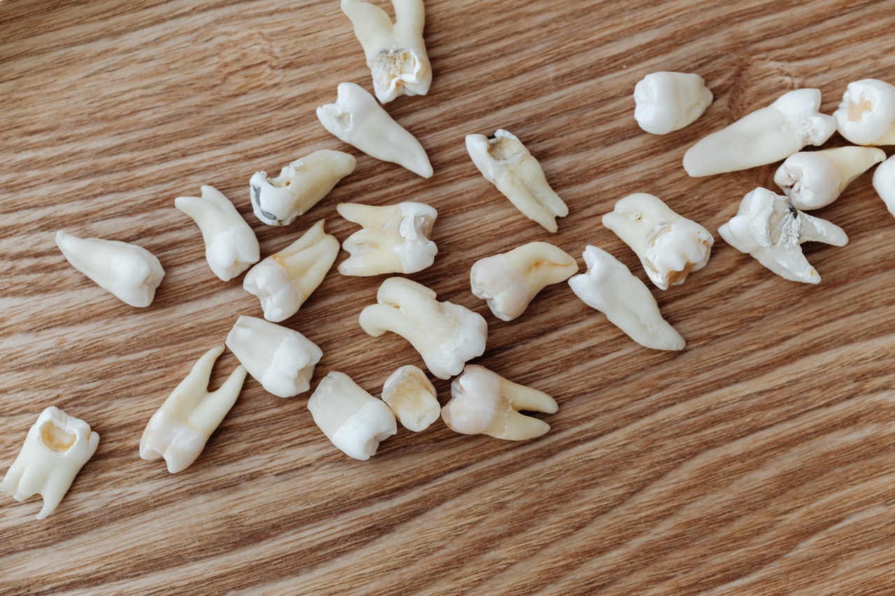 Teeth Fall Out