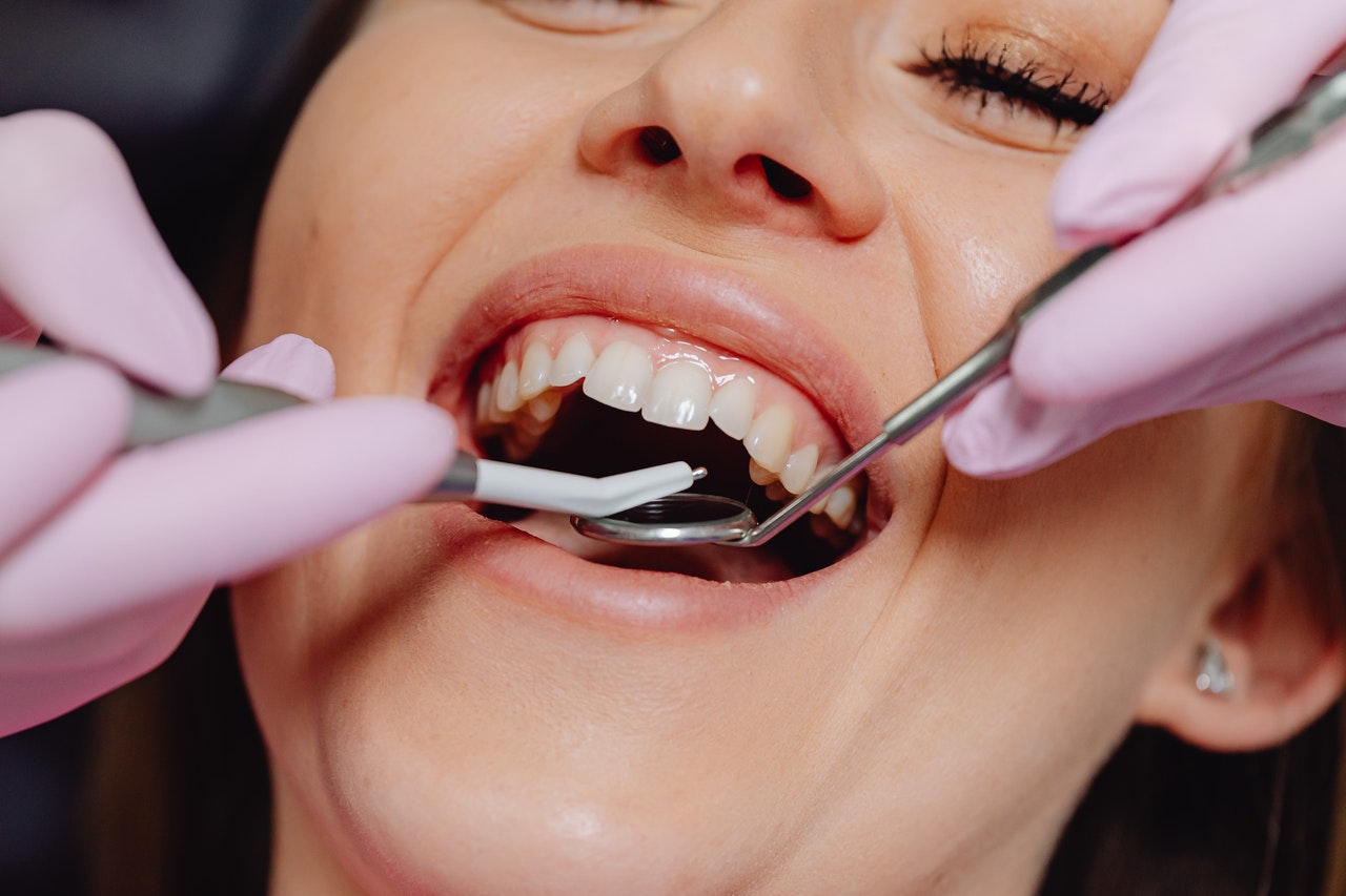 swollen gums