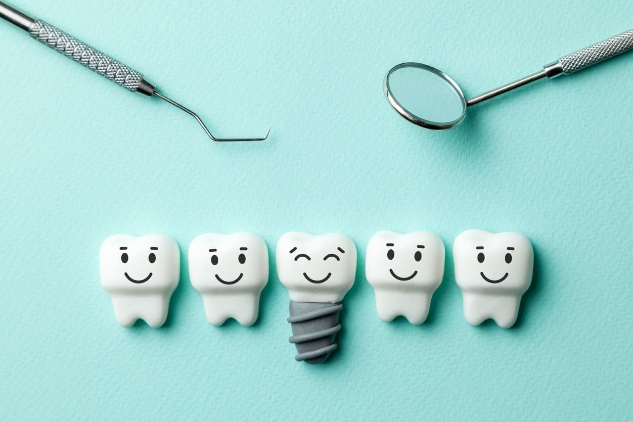 dental implants new