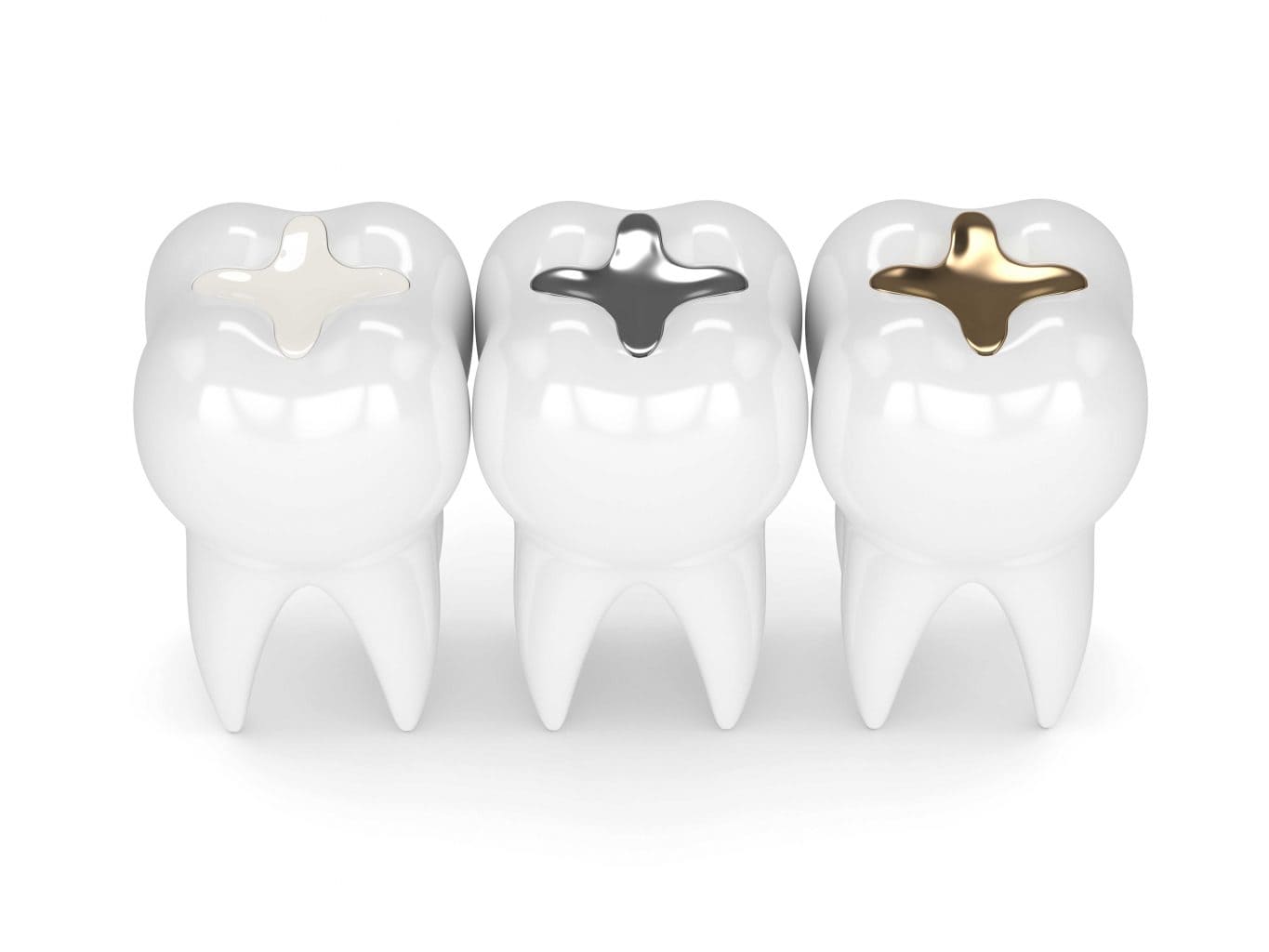 dental filling 4 1365x1024 new