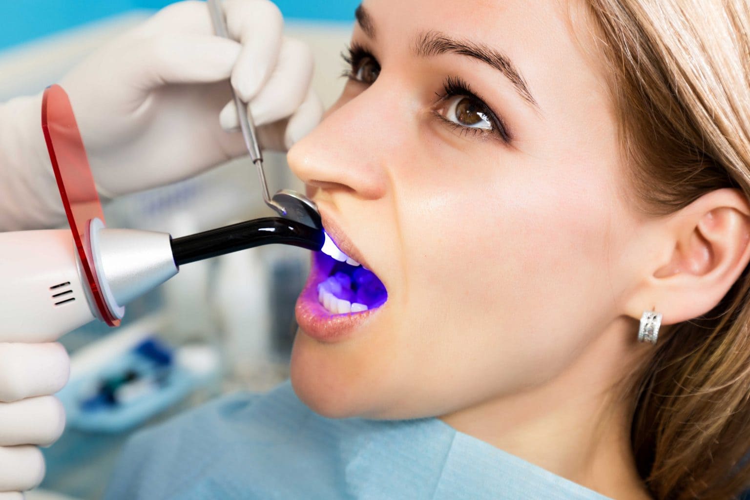 dental filling 5 1536x1024 new