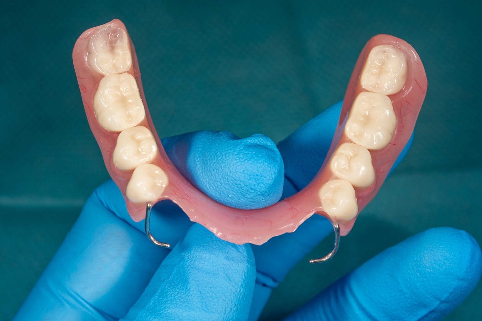 denture 6 1536x1024