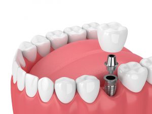 adobestock 195945547