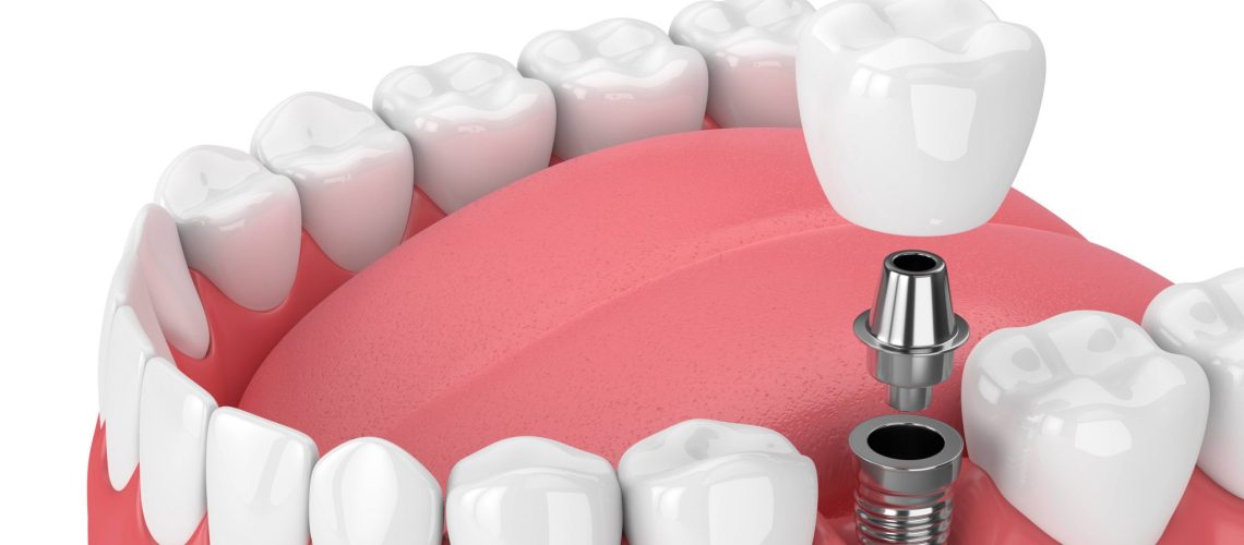 adobestock 195945547