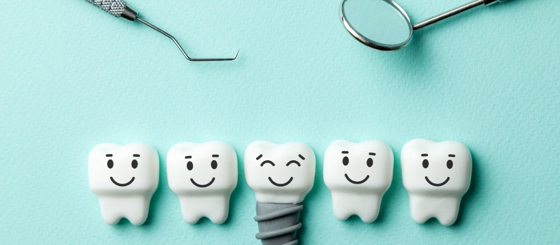 dental implants