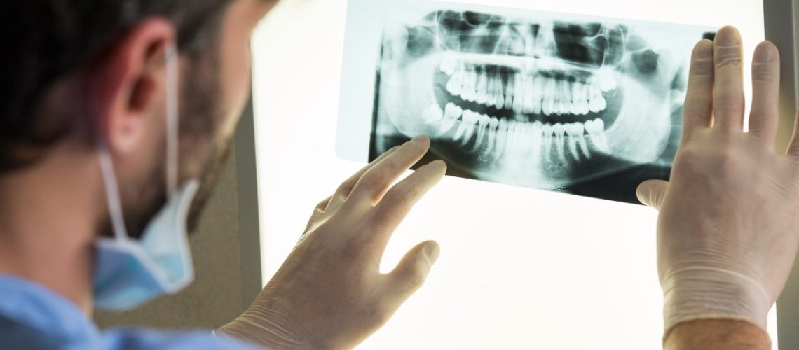 Periodontal Pockets