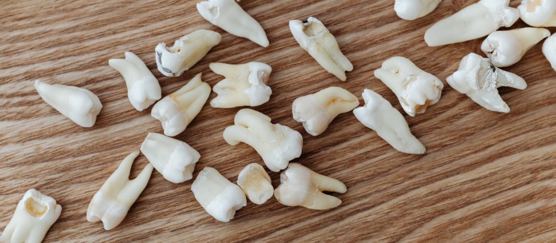 Teeth Fall Out